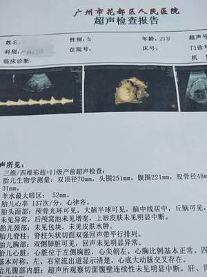 厨房水热但卫生间不热