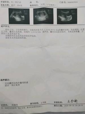 怀孕几天能看到孕囊