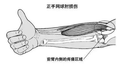 手腕内侧疼是怎么回事