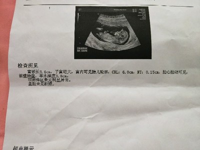 四个月胎动