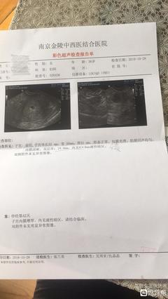怀孕几天能看到孕囊