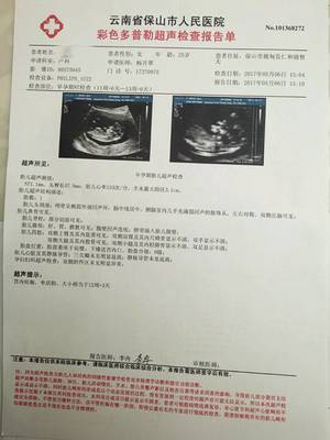 孕妇 tsh
