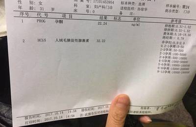 怀孕初期出血褐色少量