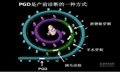 绒毛染色体基因检查多少钱