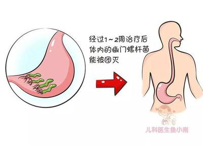 宝宝幽门螺旋杆菌