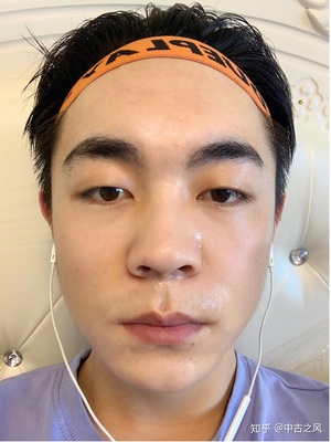 点痣留下的疤能消失吗