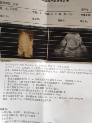 孕妇能做彩超吗