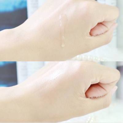 挤痘痘 冻膜