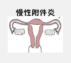附件炎影响怀孕吗