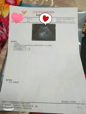 怀孕多久可以鉴定男女