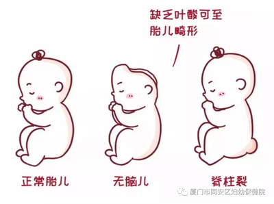 胎儿发育畸形