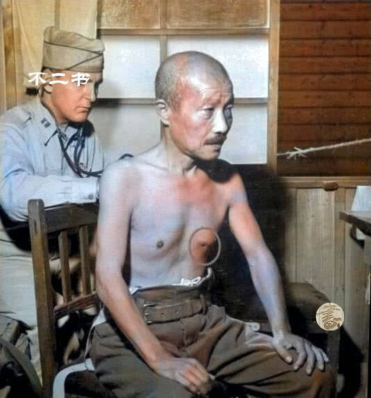 手颤抖怎么治疗