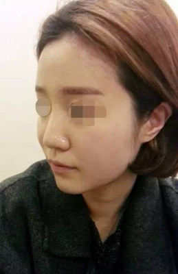 脸部麻木是怎么回事