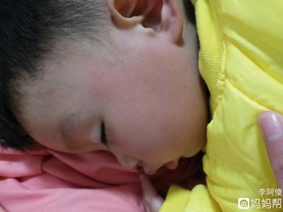 宝宝脸发红发烫怎么回事