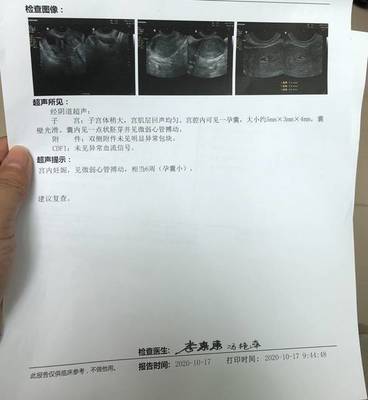 怀孕后要做什么检查