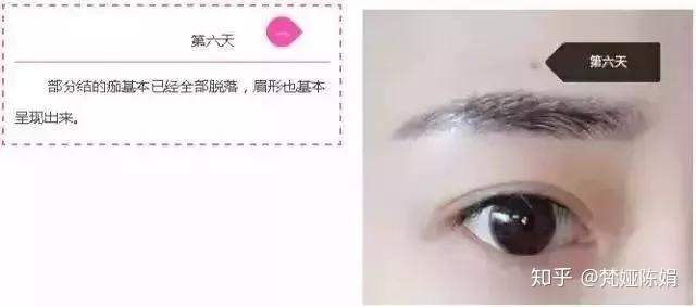 纹眉第四天