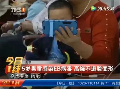五岁小孩咳嗽吃什么药