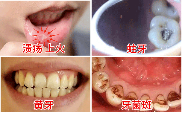 口臭一般是口腔原因吗