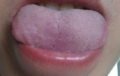 舌苔厚白是怎么回事