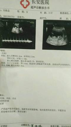 胎儿心跳太快怎么回事