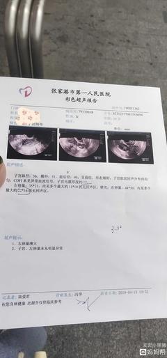 多囊怀孕
