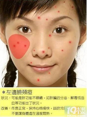 额左侧长痘痘是什么原因