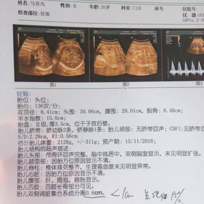 33周胎儿发育情况