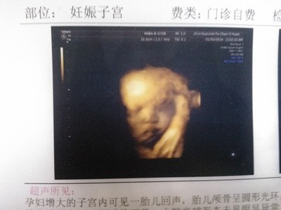 胎儿照片大全集32周