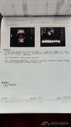 怀孕24周肚子疼是怎么回事
