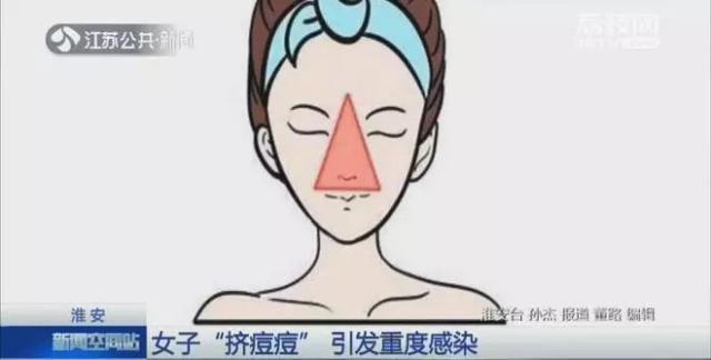 碘伏痘痘