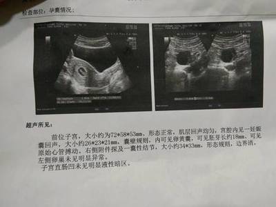 怀孕8周胎儿图片欣赏