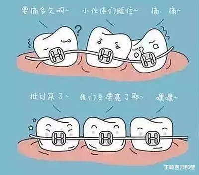 矫正牙齿的利与弊