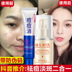 吃维生素e能去痘痘吗