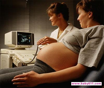 孕妇可以要求剖腹产吗