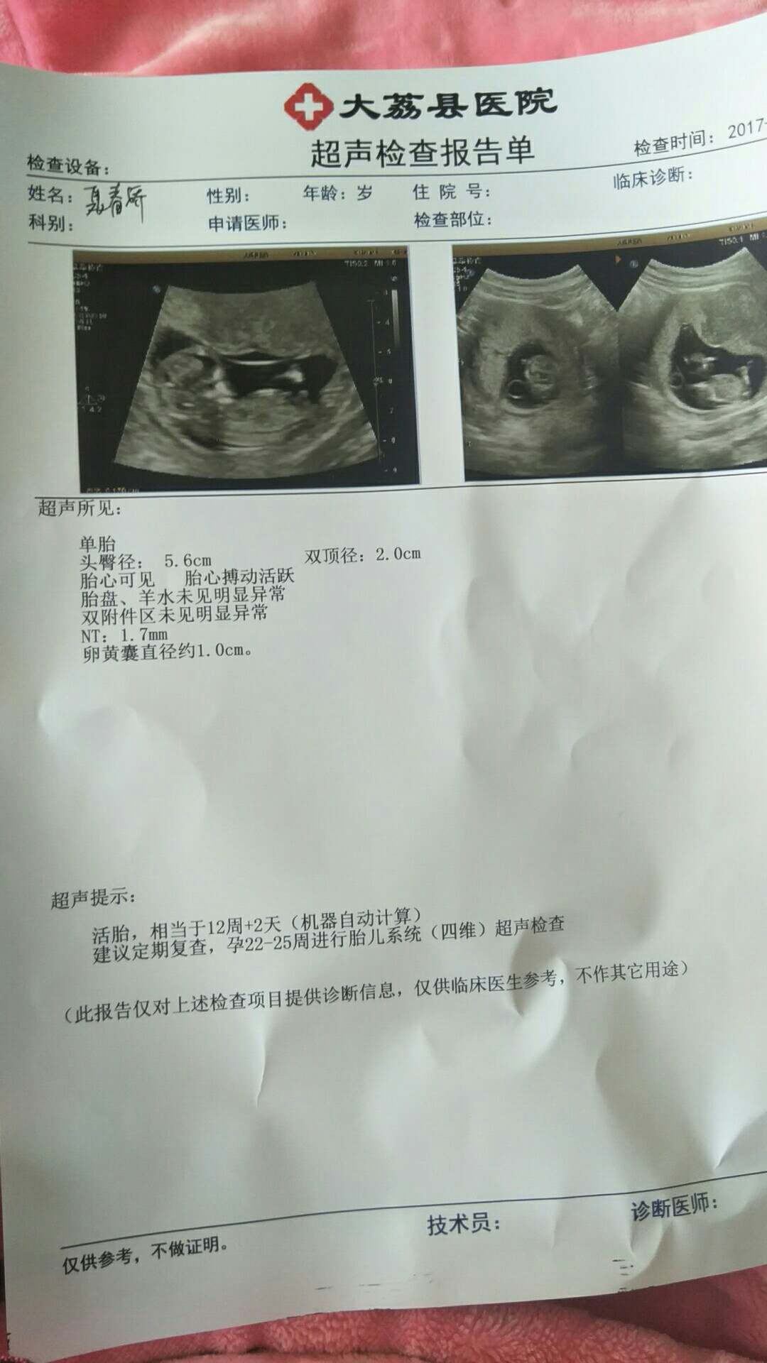 怀孕检查什么项目