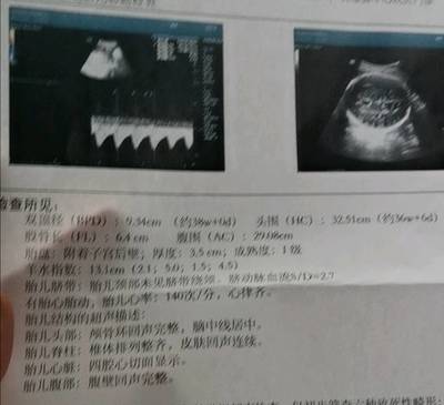 34周胎儿股骨长标准值