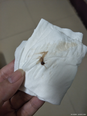 排卵期白带有血丝怎么回事