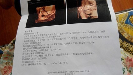 做dr后多久可以怀孕