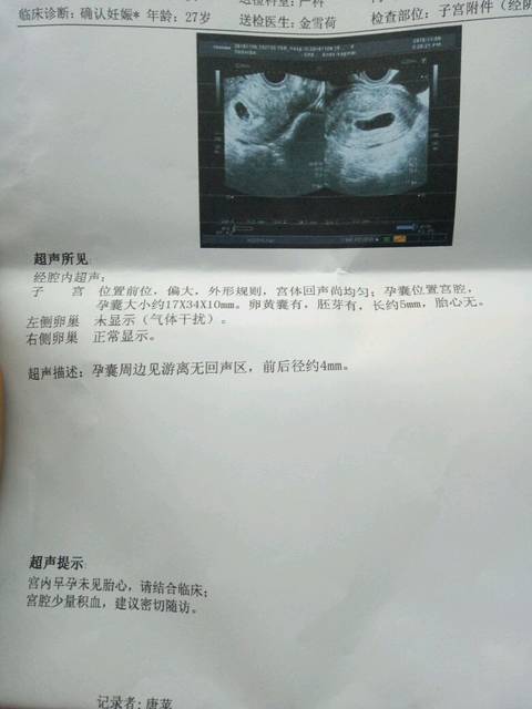 怀孕会二次发育吗
