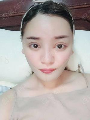 脸型不对称面相