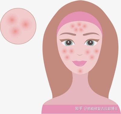 怎样消除疤痕疙瘩