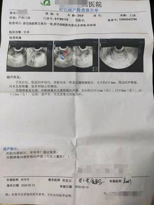 怀孕40天孩子多大