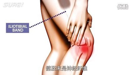 膝关节酸痛怎么治疗