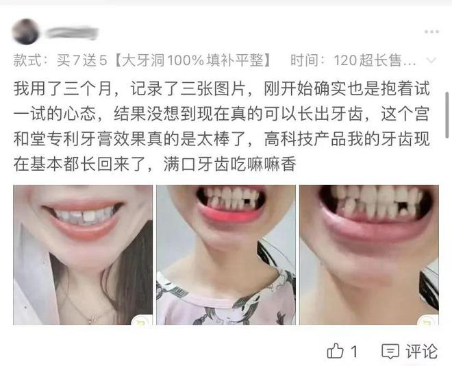做梦牙烂了怎么回事