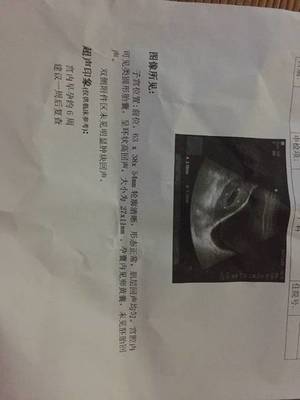刚怀孕一周会恶心吗
