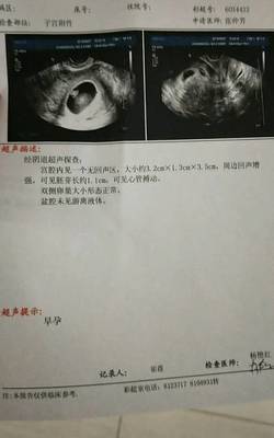 怀孕两个月宝宝多大