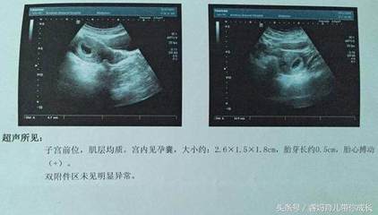 怀孕13周是孕中期吗