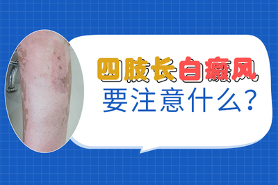 白癜风该怎么治疗好