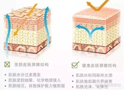 如何不容易长痘痘