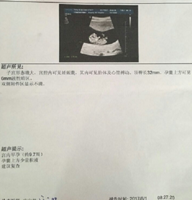 怀孕几个月检查